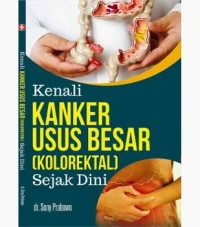Image of Kenali Kanker Usus besar (Kolorektal) Sejak DIini