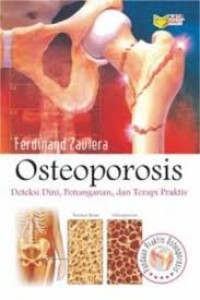 Image of Osteoporosis